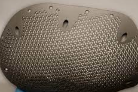 titanium skull plate